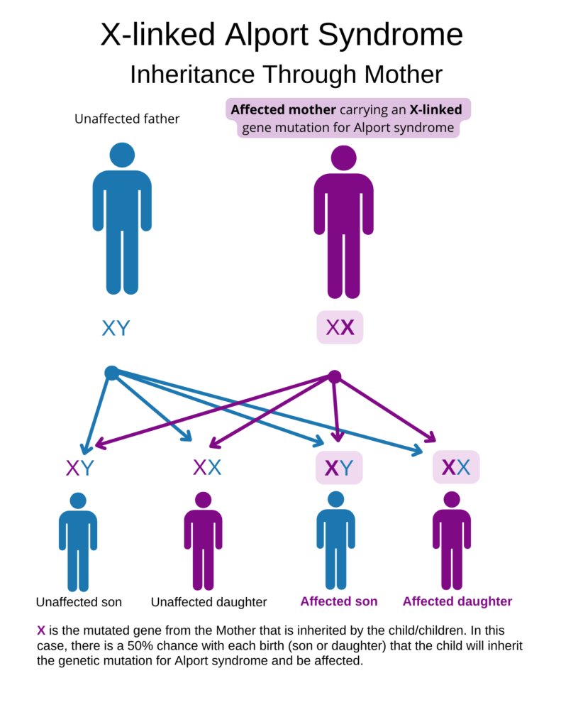 Alport Syndrome Symptoms Children